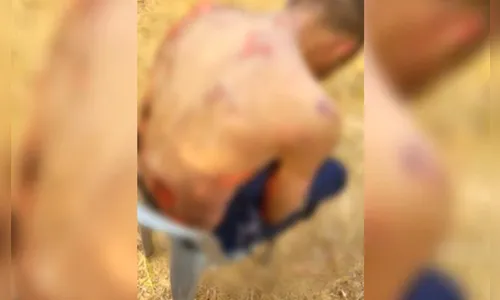 Morre homem que foi espancado e queimado por furtar sandália