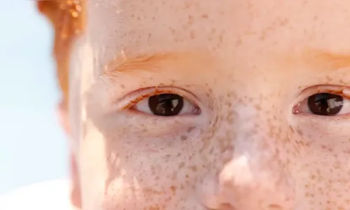 Campanha de conscientização sobre retinoblastoma começa neste sábado