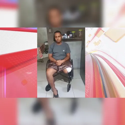 Após perder perna em acidente, jovem pede ajuda para comprar prótese