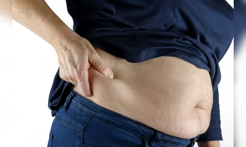 Por que as mulheres ganham peso na área do abdômen e o que fazer?