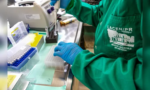 Lacen ultrapassa meio milhão de exames em 2024