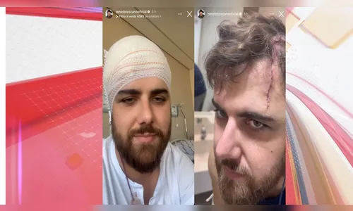 Cantor Zé Neto tranquiliza fãs nas redes sociais após acidente; veja