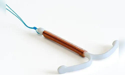 DIU sai do lugar e 'arranca pedaço' de pênis durante relação sexual