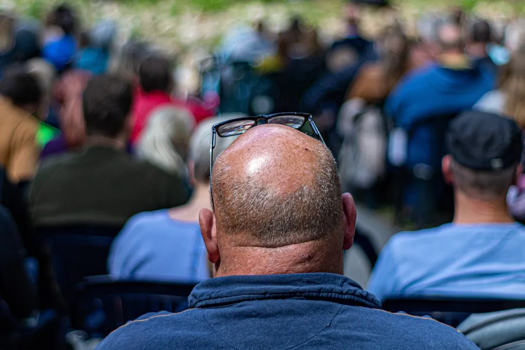 Muitas nações ao redor do mundo veem a calvície como uma circunstância natural da vida para os homens