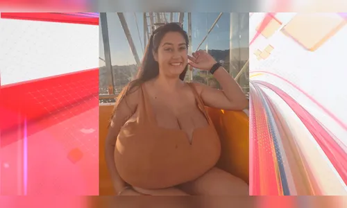 Entenda o que é gigantomastia, condição que estudante do PR enfrentou