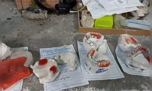 Dono de laboratório de prótese dentária clandestino é preso no Paraná