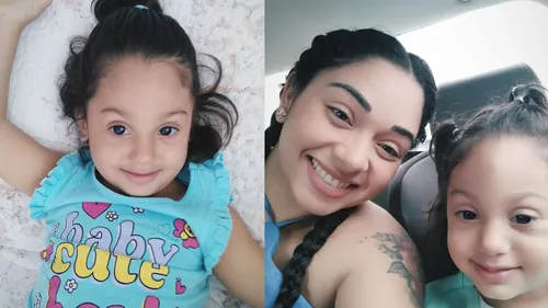 Lívia, de 2 anos e 7 meses, nasceu com uma condição rara e necessita urgentemente de uma cirurgia de reconstrução craniana