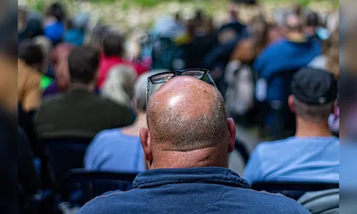 Brasil integra ranking dos países com mais homens carecas do mundo