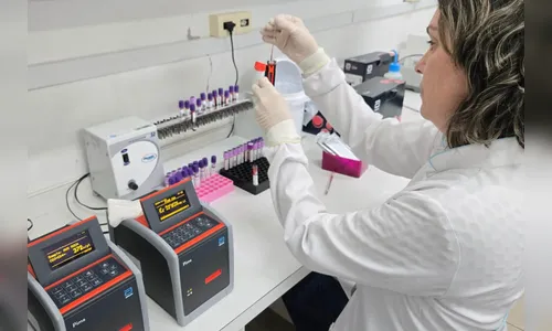 Dezembro Vermelho: Lepac da UEM é referência em diagnóstico de HIV