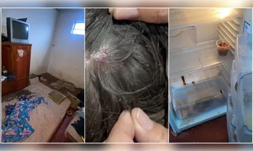 Mulher mantém filha em local infestado de piolhos e baratas e é presa