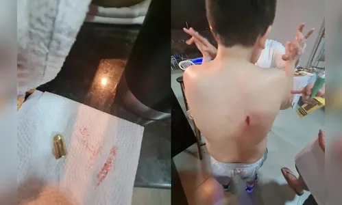 Criança é atingida de raspão por bala perdida após virada do ano no PR
