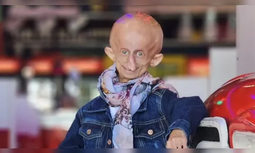 Influenciadora com doença rara morre aos 19 anos; entenda condição