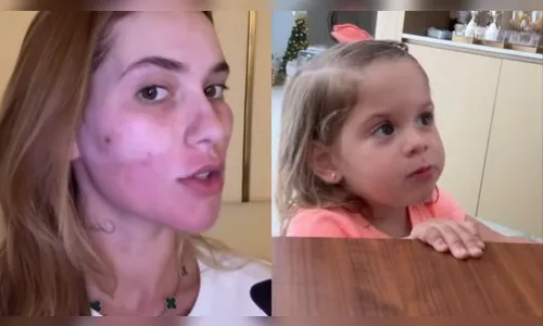 Virginia intriga Maria Flor ao colocar rosto inchado no gelo: 