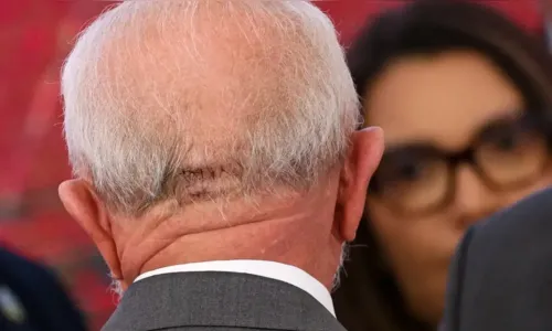 Lula passa por cirurgia de emergência para drenagem de hematoma