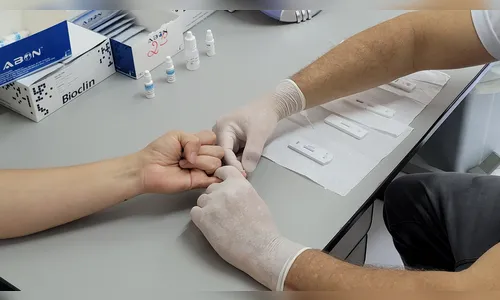 Novos diagnósticos de HIV na região superam índice do ano passado