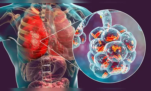 Brasil vigia surto de vírus respiratório na China e risco de pandemia