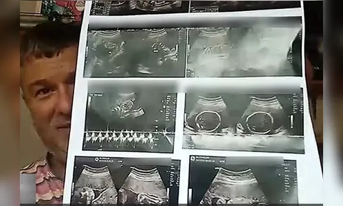 Gravidez? Homem faz exame de hérnia e se surpreende com diagnóstico