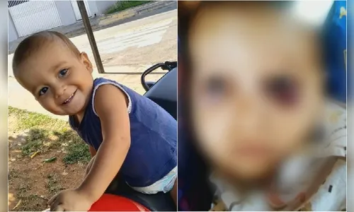 Bebê morre ao ser levado para hospital com fraturas e hematomas