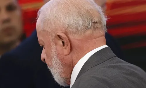 Médico divulga informações sobre estado de saúde do presidente Lula