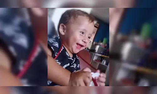 Bebê é atacado por cachorro e fica em estado grave no PR