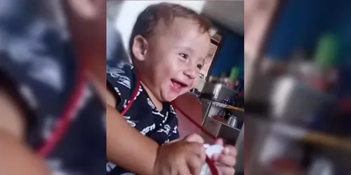Criança atacada pelo cachorro