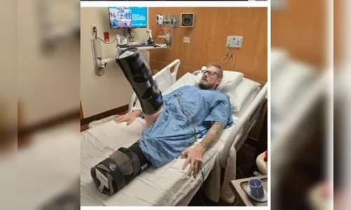 Homem acaba com as pernas amputadas após queimar mão em frigideira