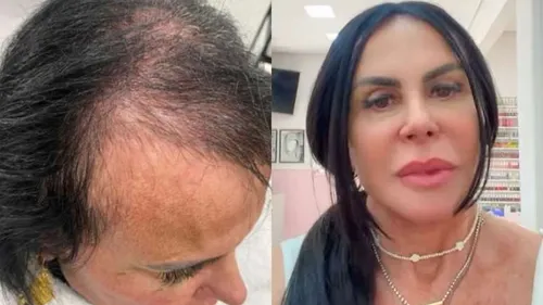 Cantora compartilhou resultado nas redes sociais