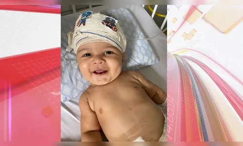 Família do bebê Davi celebra evolução após cirurgia de R$ 70 mil