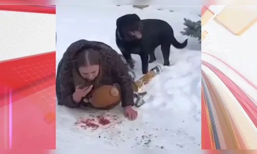 Mãe enfrenta rottweiler e é mordida por meia hora para proteger filho