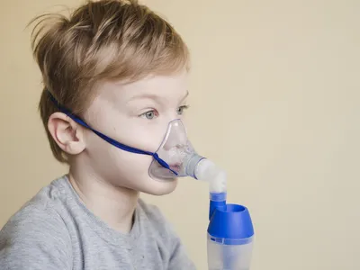 A SRAG é uma complicação respiratória causada pelo agravamento de alguma infecção viral