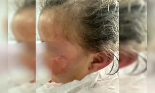 Criança de 3 anos desmaia após ser espancada pela mãe