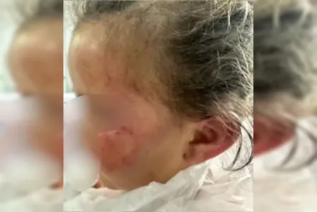 A equipe da polícia tomou conhecimento de que a mulher agrediu a criança em razão da menina ter perdido uma escova de cabelo