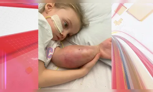 Criança com suspeita de torção no braço descobre câncer terminal