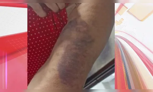 Professora é espancada por família após cobrar dever de aluno