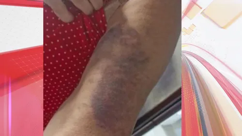 Idosa alega que foi espancada por familiares de seu aluno