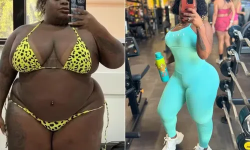 Influencer perdeu 80 kg após cirurgias e adotar rotina fitness