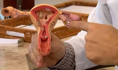 Março marca a campanha de conscientização sobre a endometriose