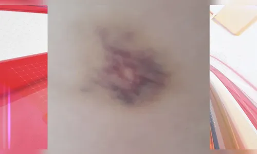 Professora procura polícia após levar soco e ser ameaçada por aluna