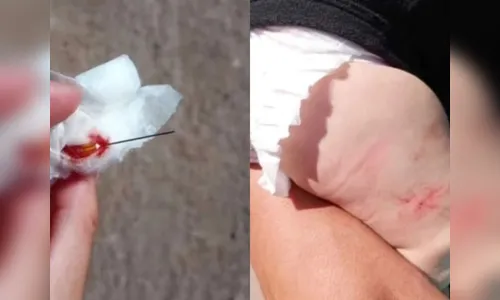 Enfermeira 'esquece' agulha em perna de bebê durante vacinação