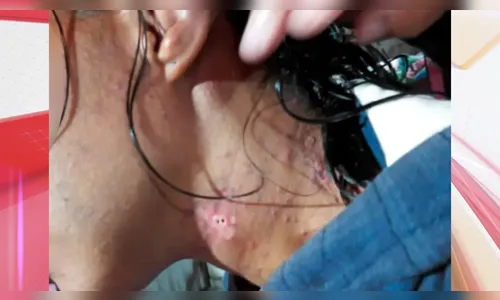 Mulher teve dentes quebrados com pedra durante cárcere privado no PR