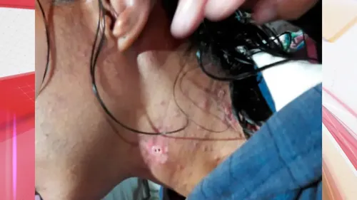 Vítima era agredida com frequência