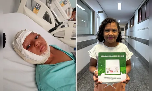 Criança que sofreu queimaduras no rosto supera trauma e publica livro