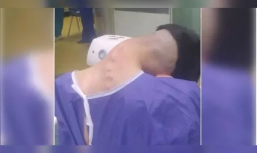 Abuso de drogas leva jovem a caso raro de ‘síndrome da cabeça caída’