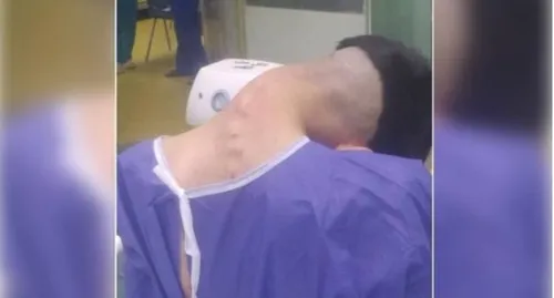 A doença, geralmente associada a distúrbios neuromusculares, neste caso foi relacionada ao uso prolongado de drogas como anfetaminas, heroína e ópio.