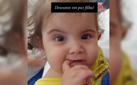 As gêmeas eram unidas pelo tórax, abdômen e bacia. Elas foram separadas em uma cirurgia de 19 horas, que iniciou dia 10 e terminou em 11 de maio.
