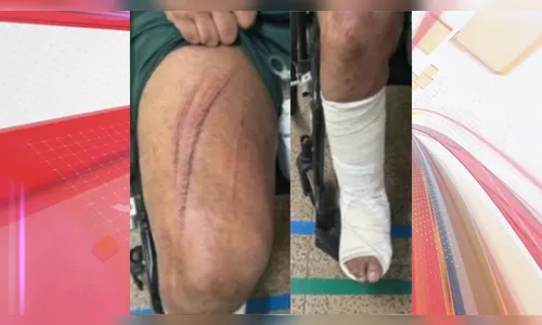 Garoto de programa pula de janela de prédio após ameaça durante ménage