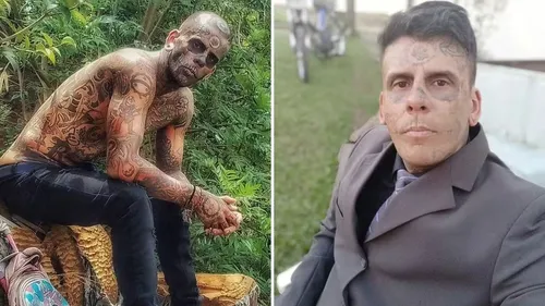Leandro ainda realizará mais quatro para eliminar completamente os desenhos.
