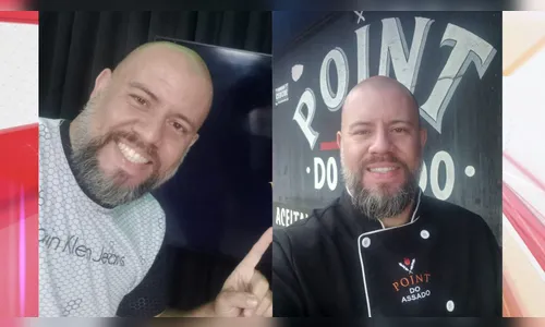 Morador de Apucarana cria vaquinha para custear cirurgia no cérebro