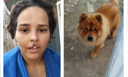 Mulher passará por cirurgia após ter lábio arrancado por cão de estimação