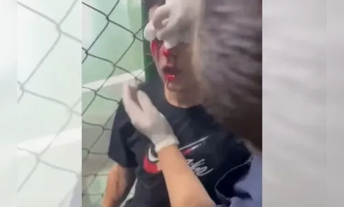 Explosão de bomba em vestiário perfura olho de jogador